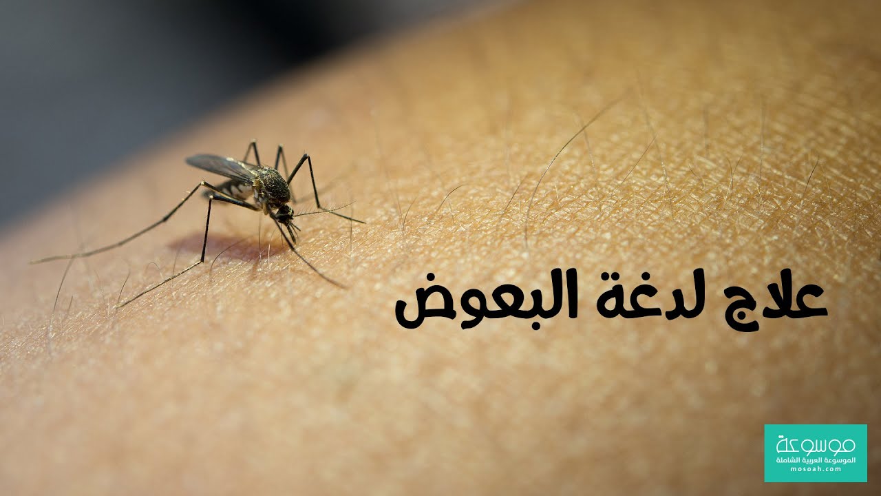 كيفية علاج لدغة البعوض ماذا اضع على قرصة البعوض Youtube