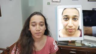 Jaw Surgery Asymmetrical Face, India Plastic Surgery - Dr. Sunil Richardson