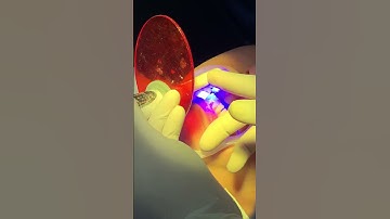 Niềng răng mắc cài kim loại sẽ như thế nào? #youtubeshorts #niengrang