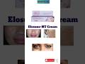 Elosone- HT cream uses || Elosone - HT shoking result #ytshorts