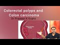 Colorectal polyps