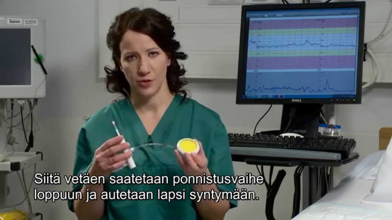 Imukuppiavusteinen synnytys FIN