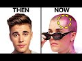 Justin Bieber's Hair Loss | Surgeon Reacts