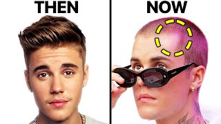 OK Exclusive Balding Bieb Justin Bieber Is Losing His Hair Thanks To  Peroxide Obsession