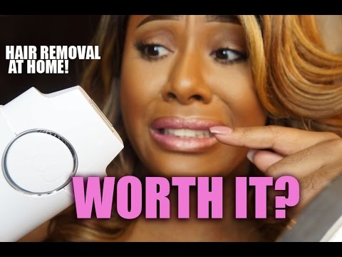 UPDATE: Laser Hair Removal At Home!! Does it Work!? - YouTube