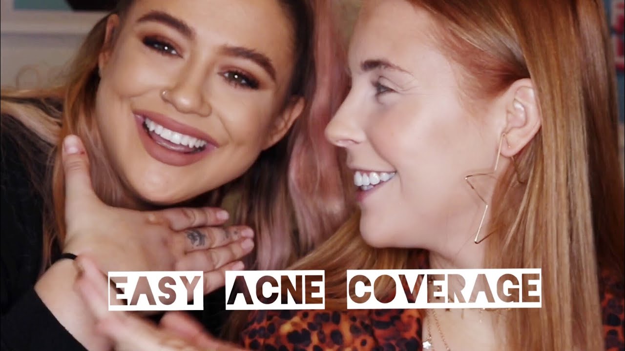EASY ACNE COVERAGE | THE BEAUTY BOM X CHESSIE KING - YouTube