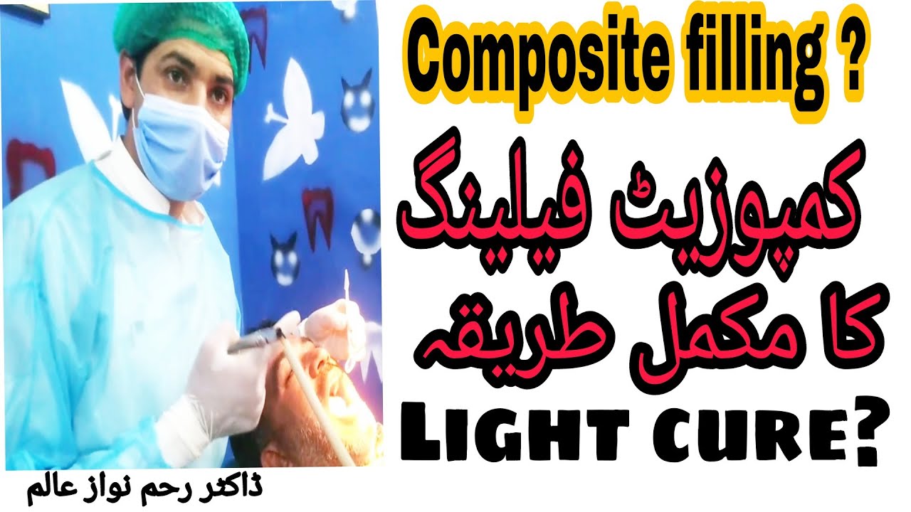 composite filling or light cure filling YouTube