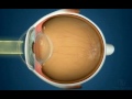 Anatomia do olho  cristalino