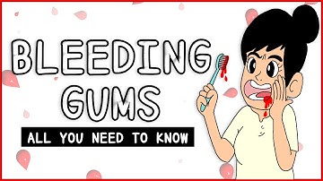 Gum Bleeding: All you need to know
