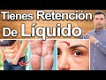 Porqué Retienes Líquidos? - Causas Y Soluciones Para Eliminar La Retención De Líquidos