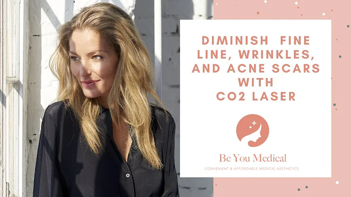 CO2 Laser Treatment- What to Know