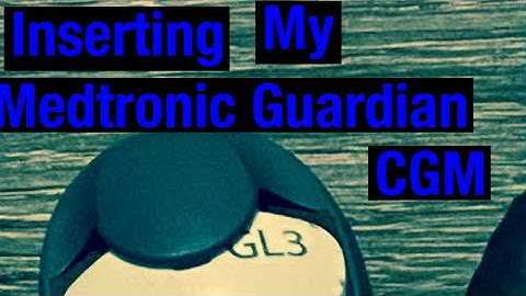 Inserting the Medtronic Guardian Link 3 CGM