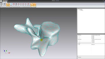 Surface reconstruction from point cloud data