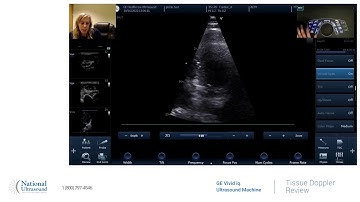 GE Vivid IQ Tissue Doppler Training Video