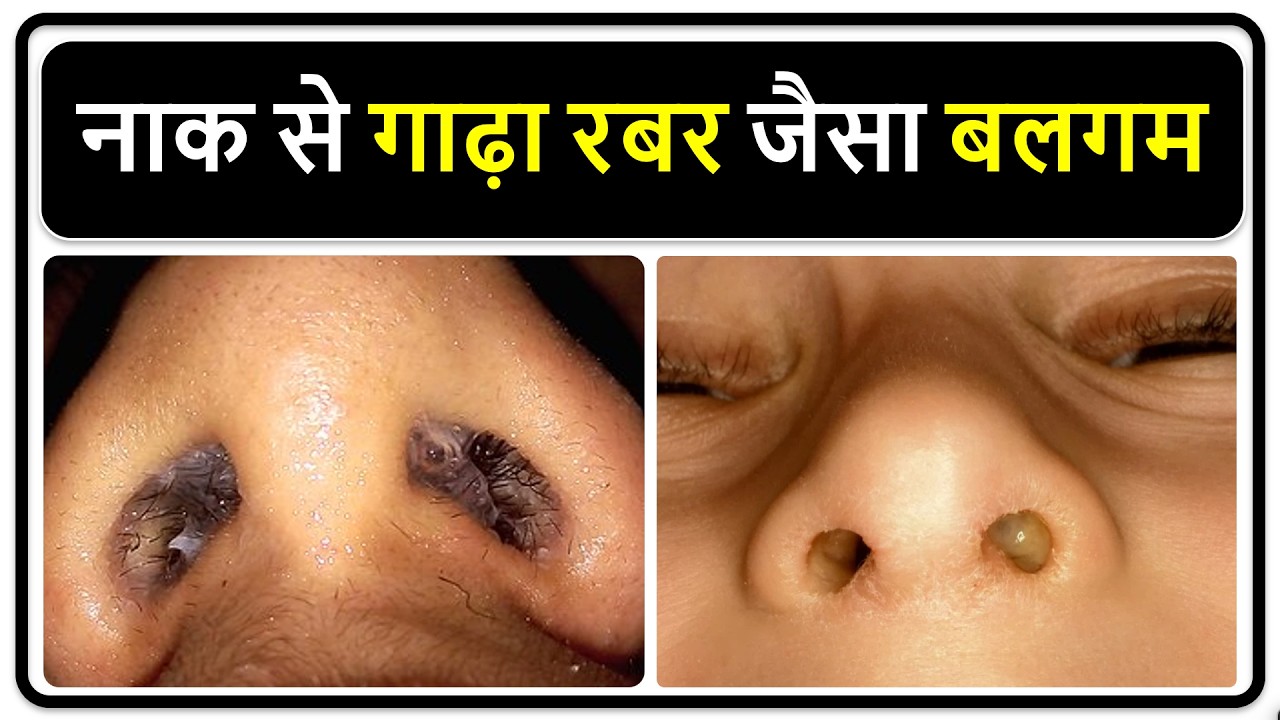 Kirish joyida sikilgan odamlarning porno fotosuratlari Qiz birinchi marta anal jinsiy aloqa qilishga harakat qiladi