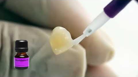 IVOCLAR MULTILINK N SYSTEM PACK - DENTBEAR