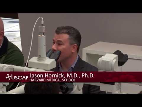 USCAP: Jason Hornick's Deep Soft Tissue Tumors, Spindle Cell Tumors