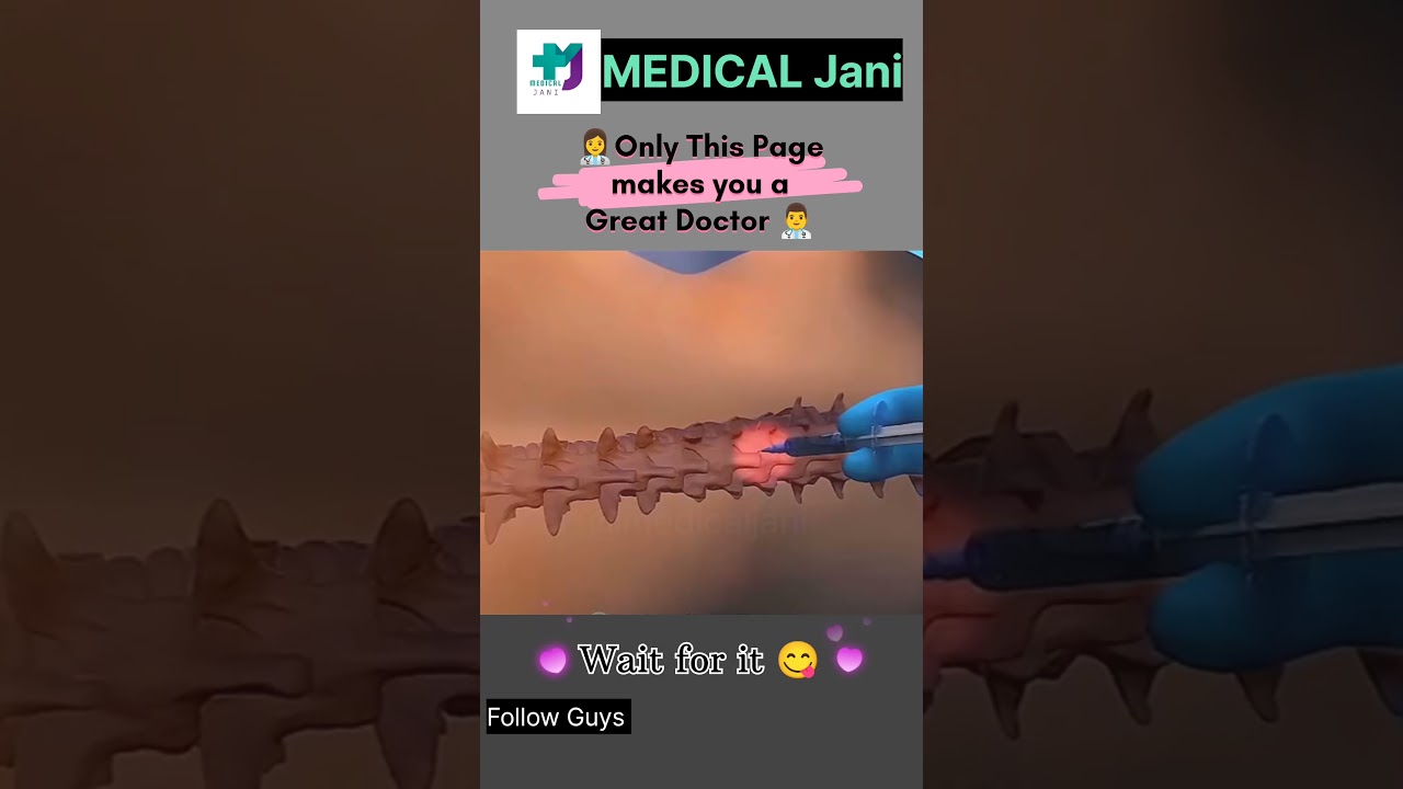 A cesarean section 3d animation video (C-section) 