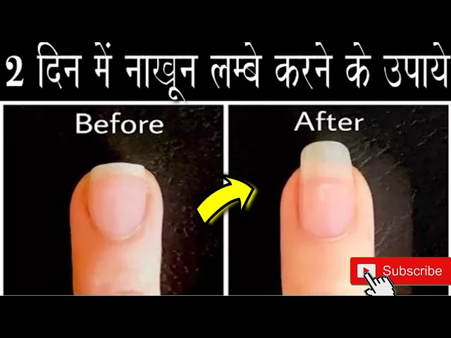 How to grow strong fingernails, news and tips