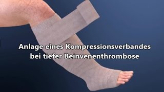 Kompressionsverband bei Thrombose