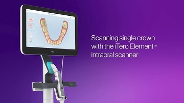 How to scan a single crown with the iTero Element™ Plus scanner | step-by-step execution