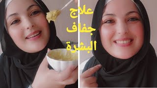 وصفة تخلصك من جفاف البشرة تجعل وجهك صافي بدون تصبغات مع نصائح عن منتجات جربتهم شخصيا ماتندميش عليهم