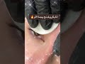 المايكروبلدنج تاتو رسم الحواجب شعره شعره 🔥 #العناية_بالبشرة #بايولايت #biolight0 #explore #اكسبلور