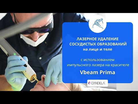 ЛАЗЕРНОЕ УДАЛЕНИЕ СОСУДИСТЫХ ОБРАЗОВАНИЙ НА ЛИЦЕ И ТЕЛЕ