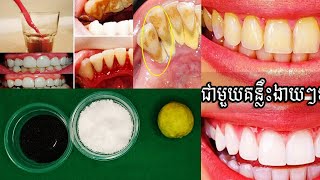 រូបមន្តធ្វើអោយធ្មេញសបែបសាមញ្ញ Simple teeth whitening formula