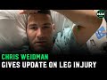 Chris Weidman updates on brutal leg injury: "Between 6 and 12 months before I can train.."