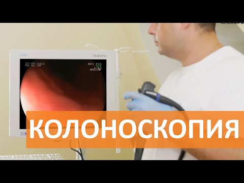 Колоноскопия. Колоноскопия под наркозом