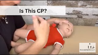 Atypical Development Baby - Does my baby have cerebral palsy? I’m worried about his development.