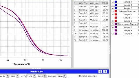 Episode 7   HRM Analysis