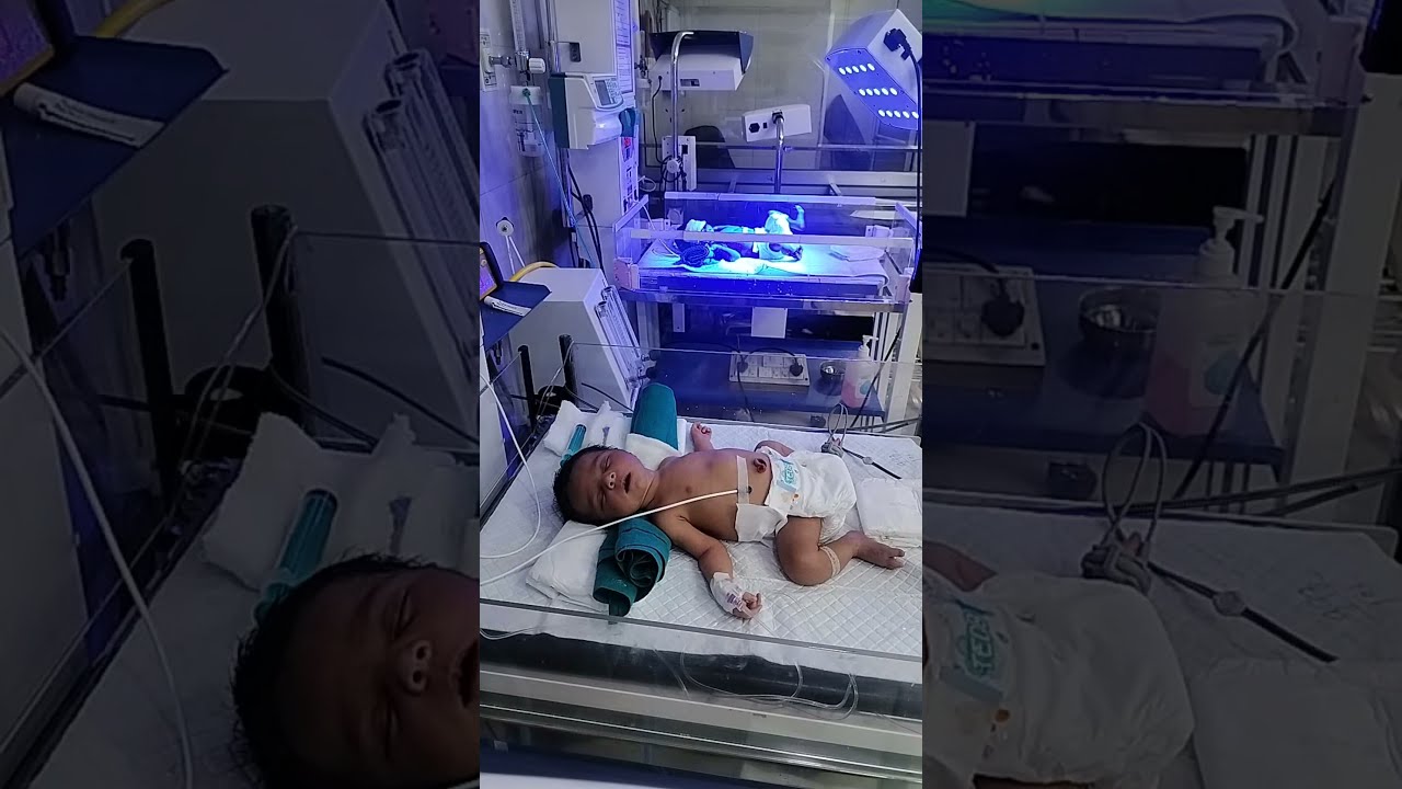 Icu And Nicu Care Treatment In NICU Picu