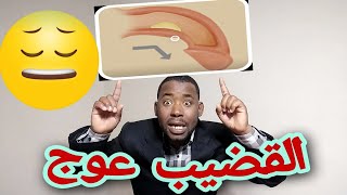 احسن وصفة لعلاج مشكل إعوجاج القضيب عند الرجال