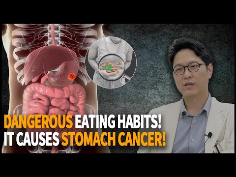 Stomach Cancer Signs,
