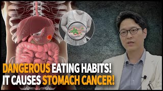 Stomach Cancer Signs, Causes, Diagnosis, Treatment, Genetics, Survival Rate, And More.