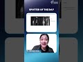 Spotter of the Day by Dr. Zainab Vora | Conceptual Radiology | Radioogy Residency #shorts