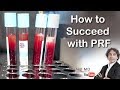 HOW TO EXCEED WITH PRF FACE INJECTIONS-Dr Rajani