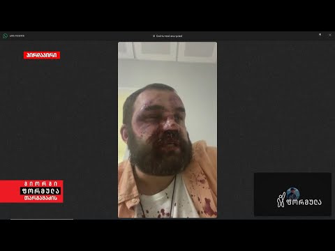 2 ადამიანი იყო ქუდებით სადარბაზოს კარებთან — დიმიტრი ჩიქოვანს საკუთარ სახლთან თავს დაესხნენ