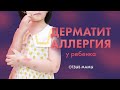 Аллергия у ребенка. Метабиотик X-code помог справиться с проблемой, которая беспокоила 4 года.