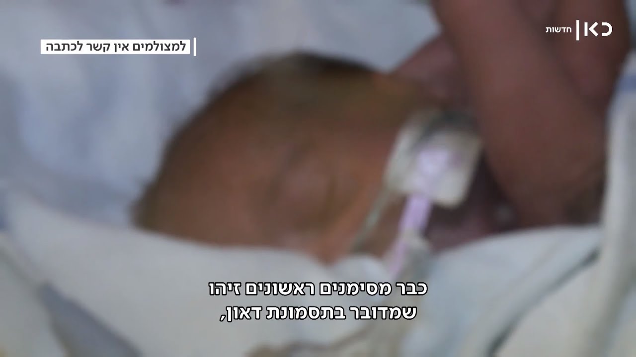 תינוקת של אף אחד: ההורים החליטו לוותר עליה, הרווחה מסרבת למצוא לה בית