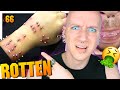 When Surface Piercings Go Terribly Wrong | Piercings Fails 66 | Roly Reacts