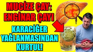 KARACİĞER YAĞLANMASI BU ÇAY İLE SONA ERİYOR– ENGİNAR YAPRAĞI ÇAYI