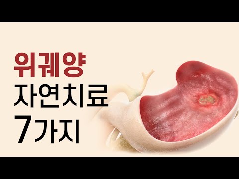 위궤양 원인부터 고치는 7가지 자연치료