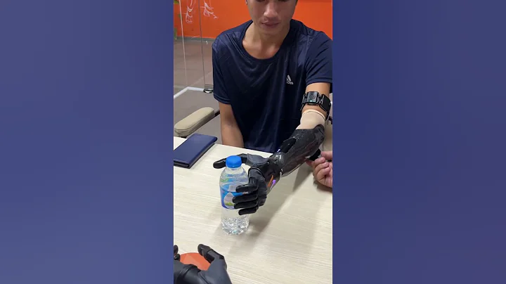 Vulcan Upper Limb Prosthetic Arm Fitting Day #shorts