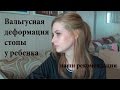 ВАЛЬГУСНАЯ ДЕФОРМАЦИЯ СТОПЫ/ как мы исправляем