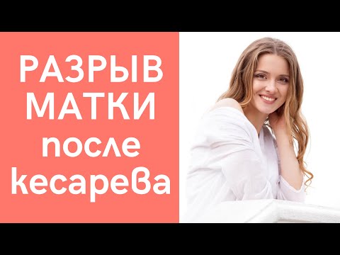 ГЛАВНОЕ! Естественные роды после кесарева сечения