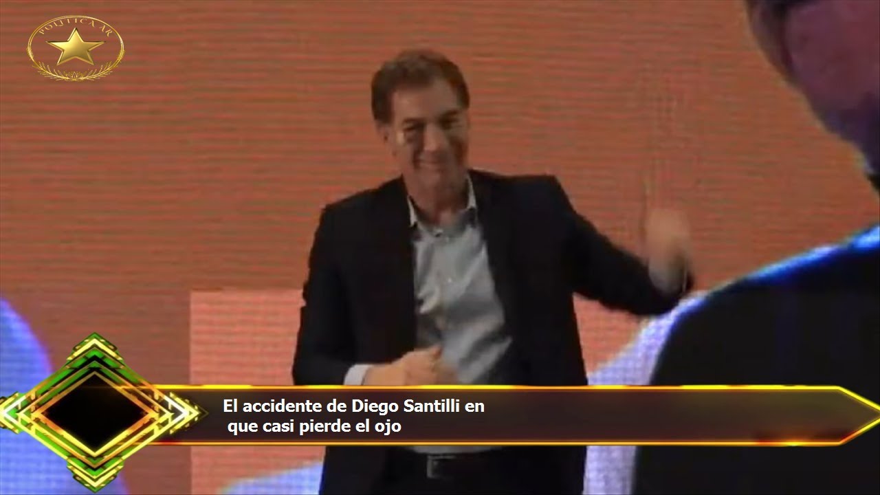 El accidente de Diego Santilli en que casi pierde el ojo - YouTube