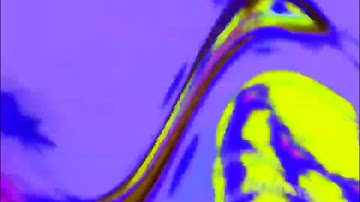 Preview 2 MCT V1 G Major 2 in Wiggle Major Powers